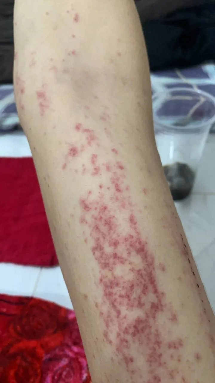 #群友投稿：柬埔寨第三安置点，根本没有把我们当成人对待